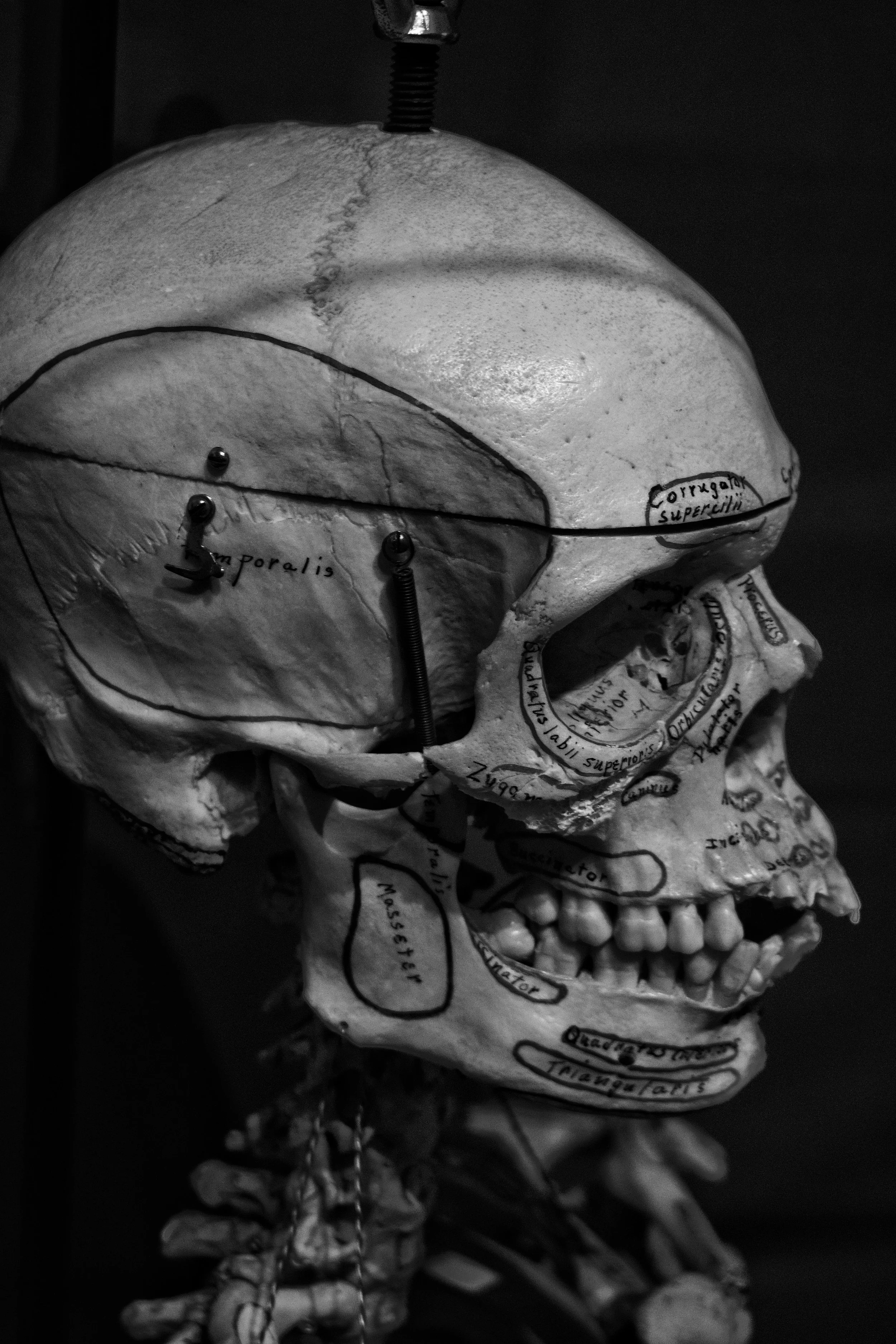A black and white anatomical model of a human skull with labels and markings indicating different regions and bones, including the parietal and occipital bones.