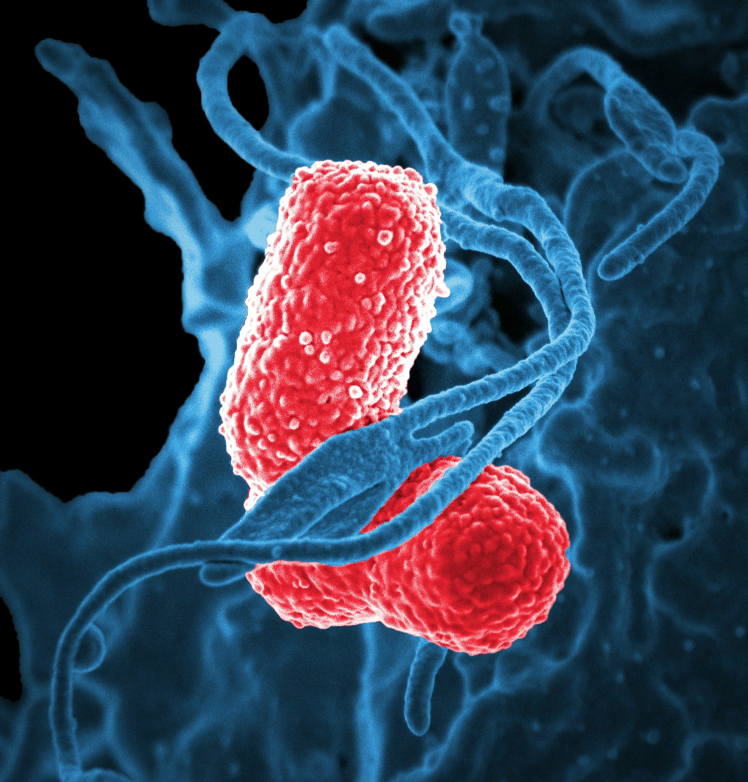 Gut–Brain Axis &amp; Burnout (why stress weeks flare digestion)