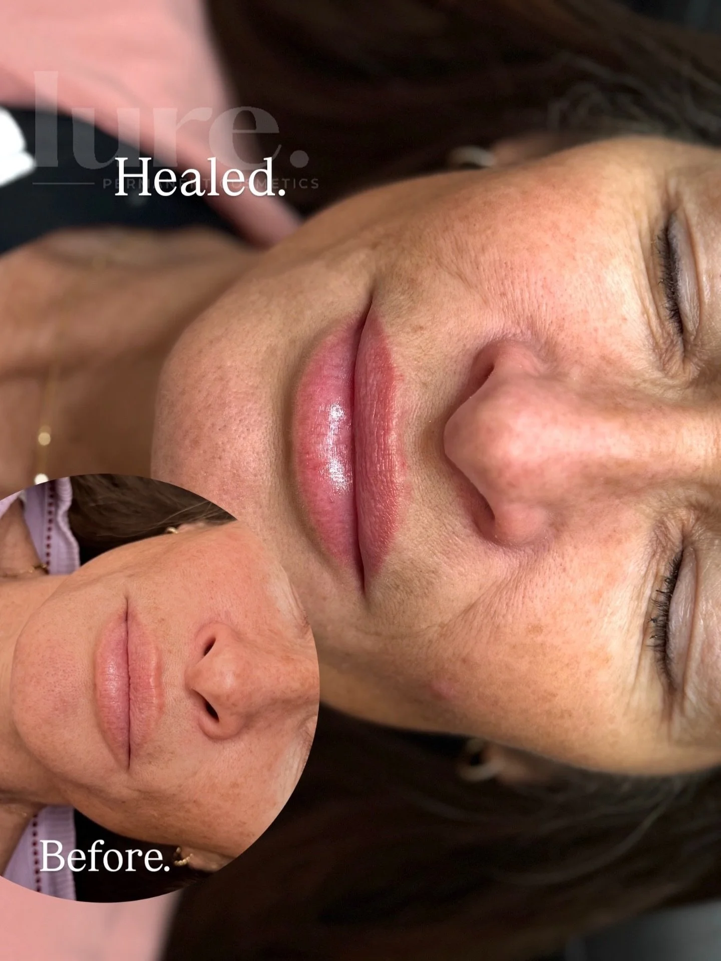 &ldquo;What a game changer.&rdquo; 👈 her words, not mine. 

Well, I nodded and mmmhmm&rsquo;d. I mean 🤷🏽&zwj;♀️ Lip Blush&mdash; yeah&mdash; it really is. 

Tell yo&rsquo; friends ✌️

#mesalipblush #healedlipblush #gilbertlipblush #lipblush #azlip