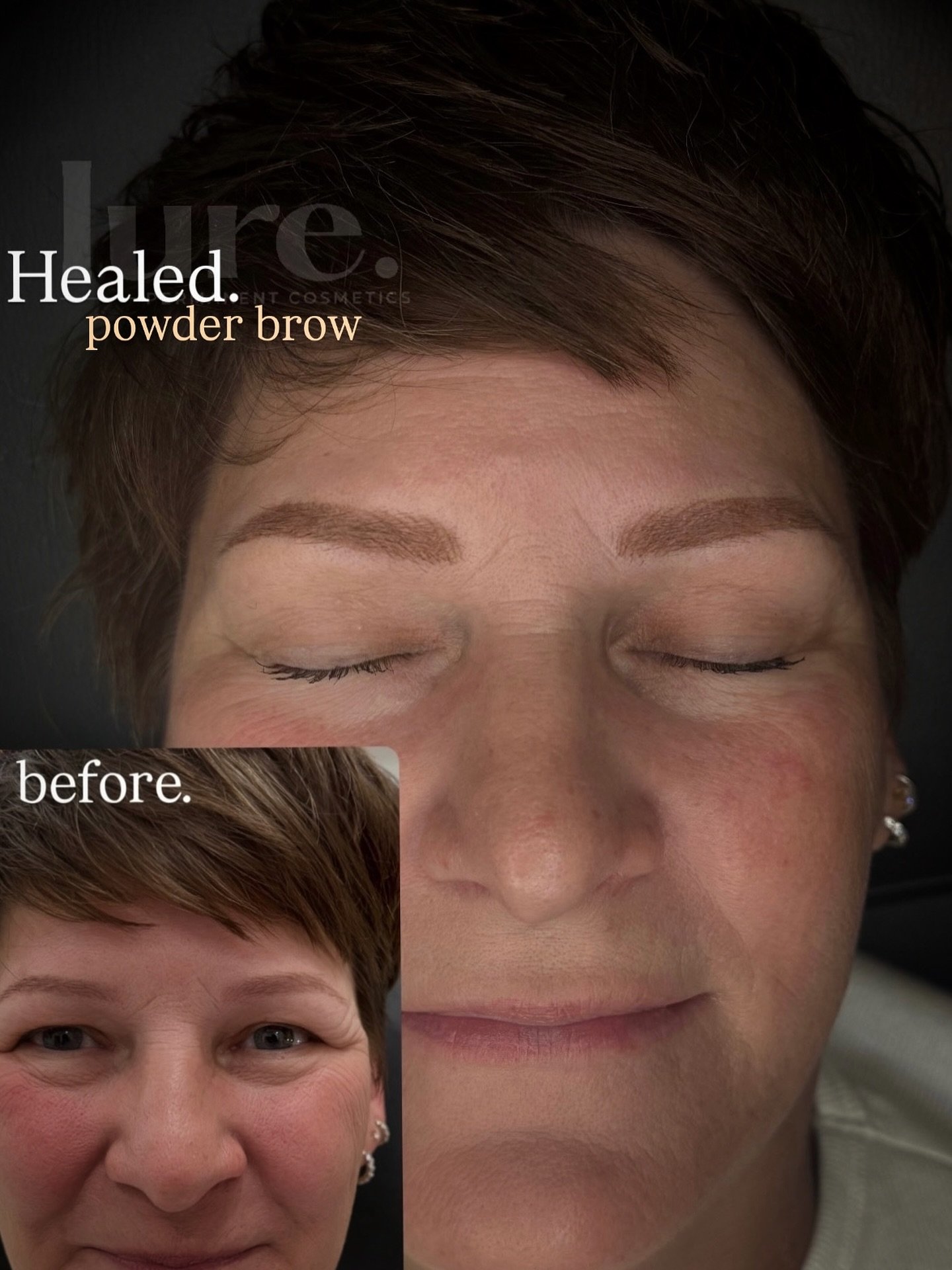 Not every client is a candidate for purely nano brows (hairstrokes) &mdash; and that&rsquo;s where experience matters.

This client came in with previous PMU that needed balancing and symmetry correction. When there&rsquo;s already saturation in the 