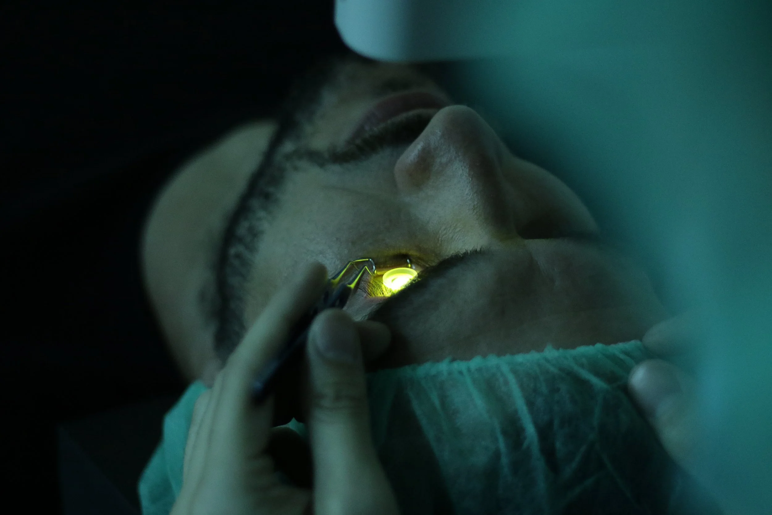 Cornea Cross-linking.jpg