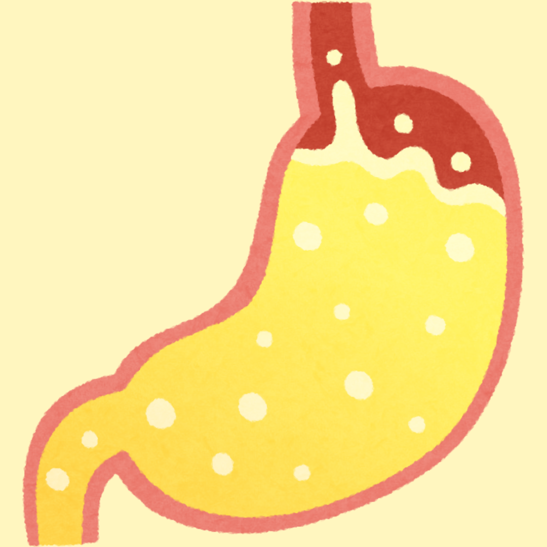 5 Ways to Reduce Acid Reflux (Without Reaching for the Antacids Straight Away)