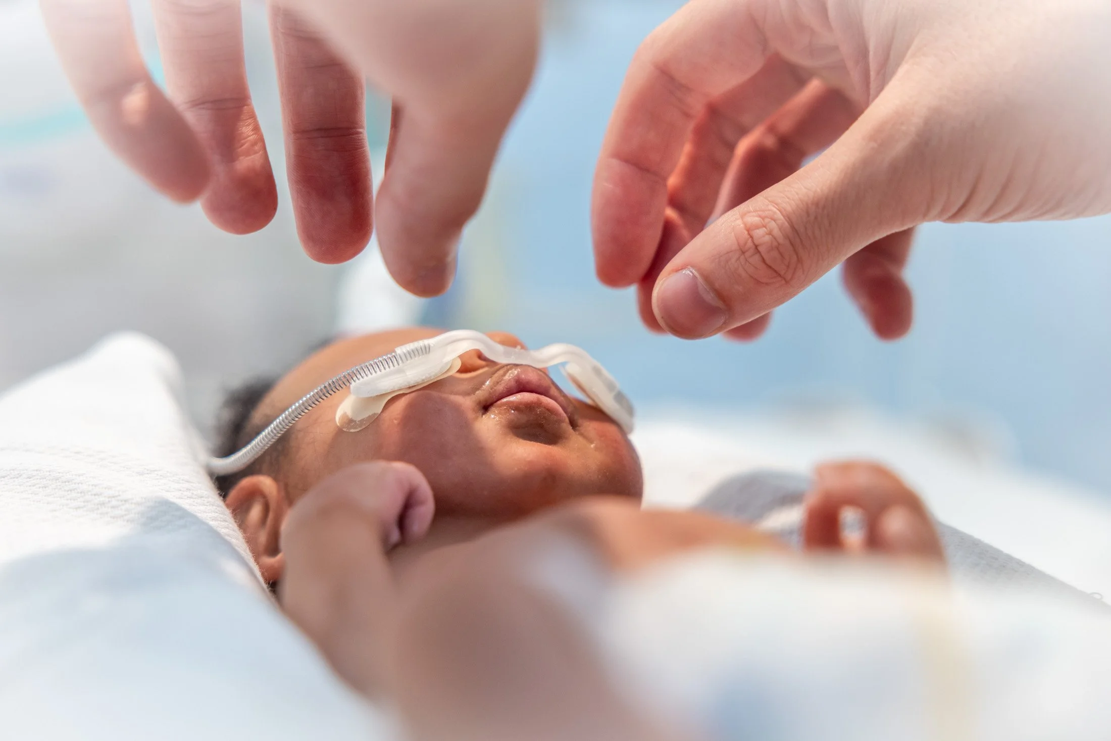 Close-up of a newborn baby with oxygen tube, being touched gently by adult hands.