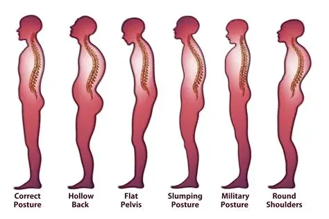 a picture different types of bad posture due to breathing