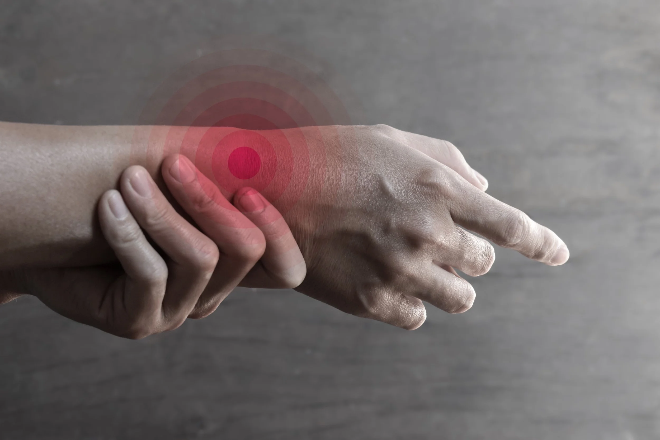 Inflammation of fractured wrist joint and hand. Concept of joint pain and hand problems