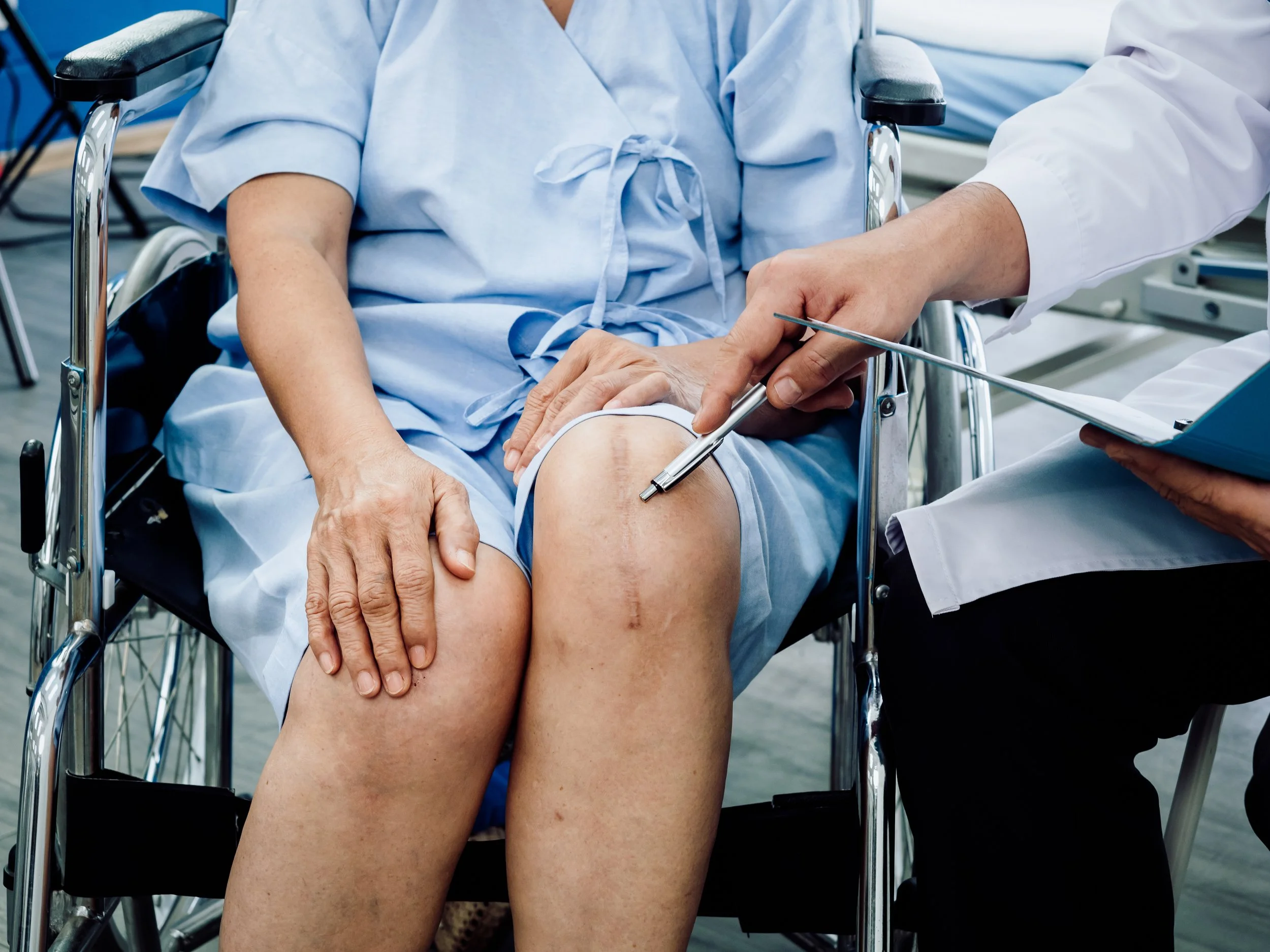 Knee surgery scar. Close-up scars surgical total knee joint replacement on elderly lady on wheelchair