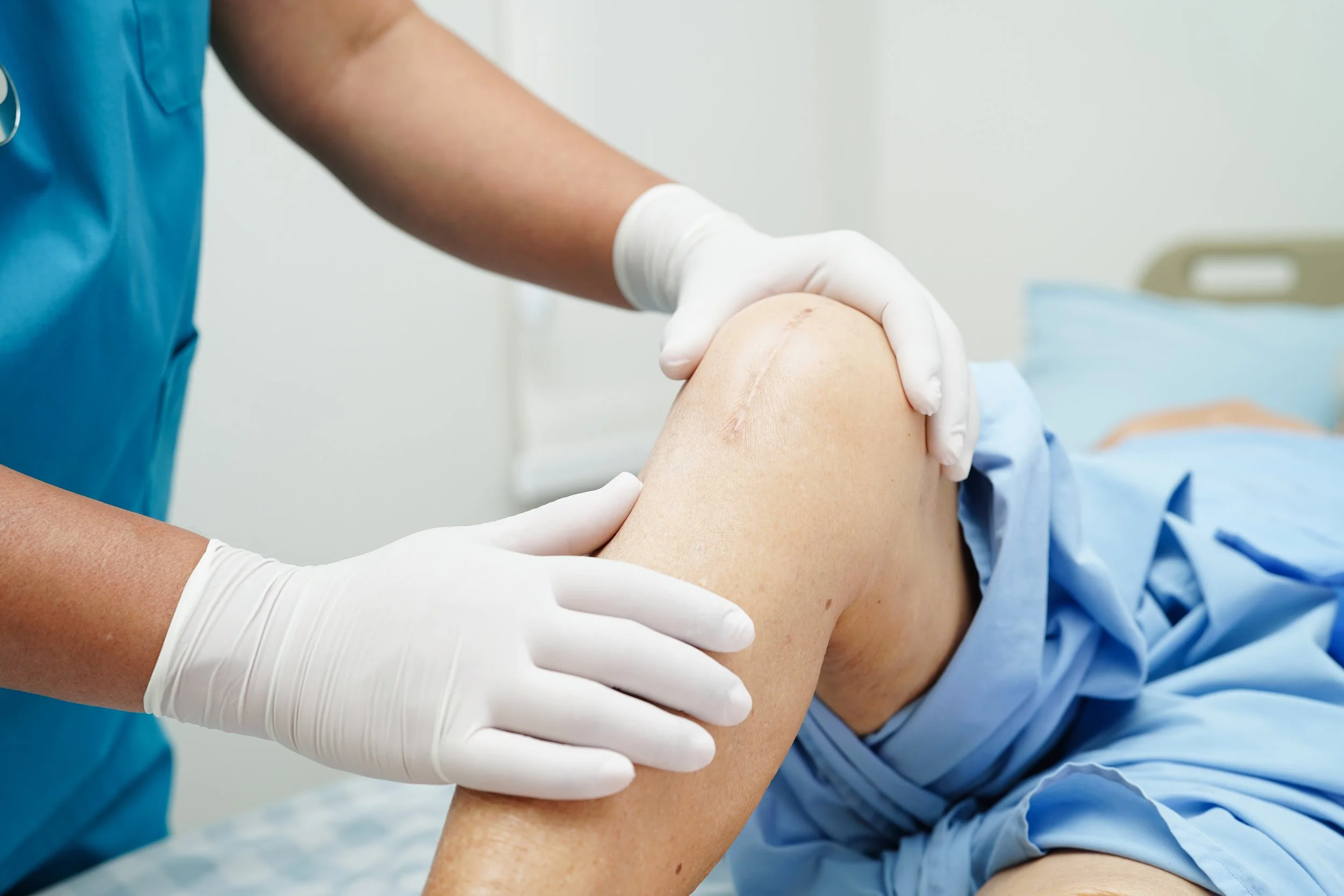 physiotherapist checking elderly woman patient with scar knee replacement surgery for physiotherapy and rehabilitation