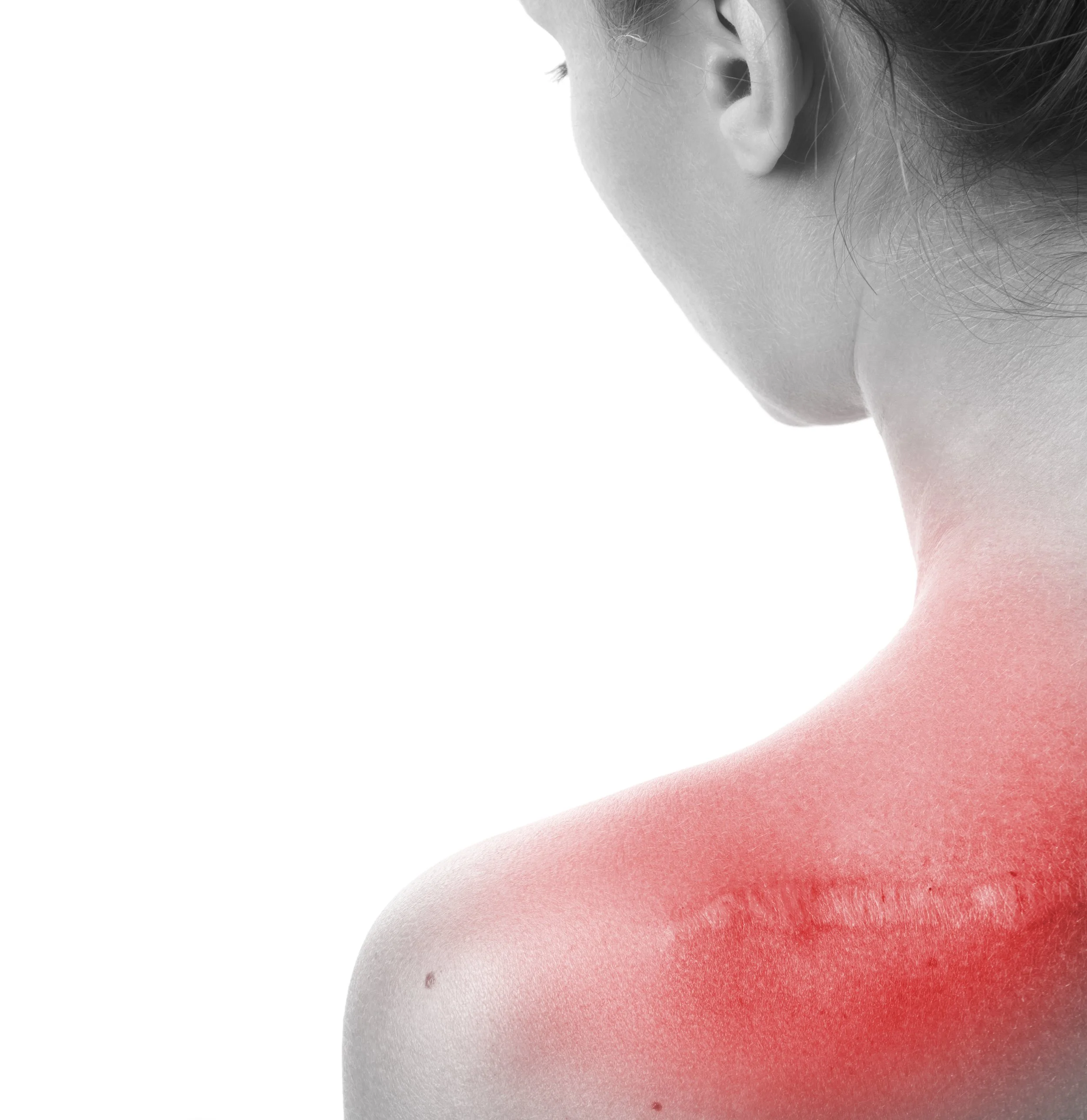 woman facing backwards with healed horizontal scar on shoulder from surgery