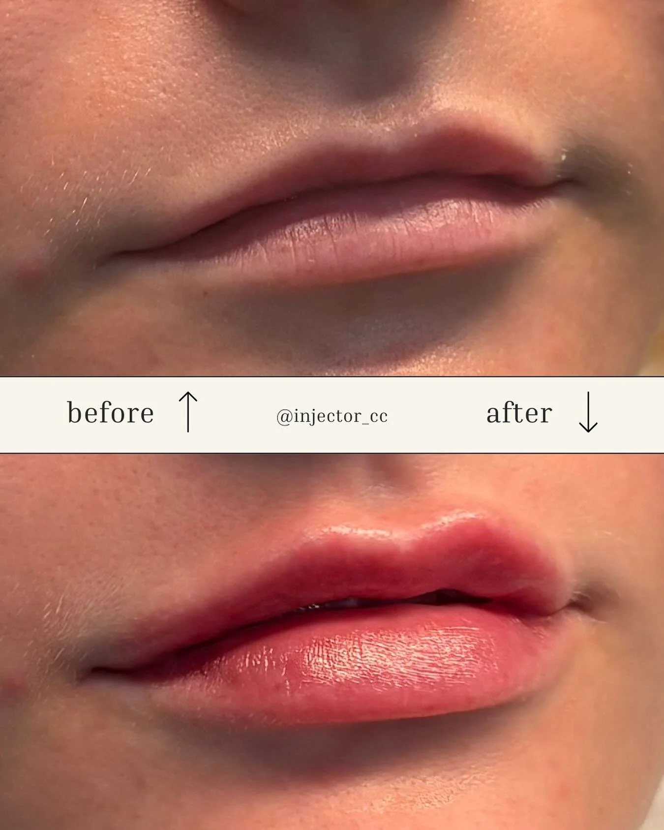 A little lip magic goes a long way 💋

 Now booking your glow-up at The Med Beauty Spa.✨