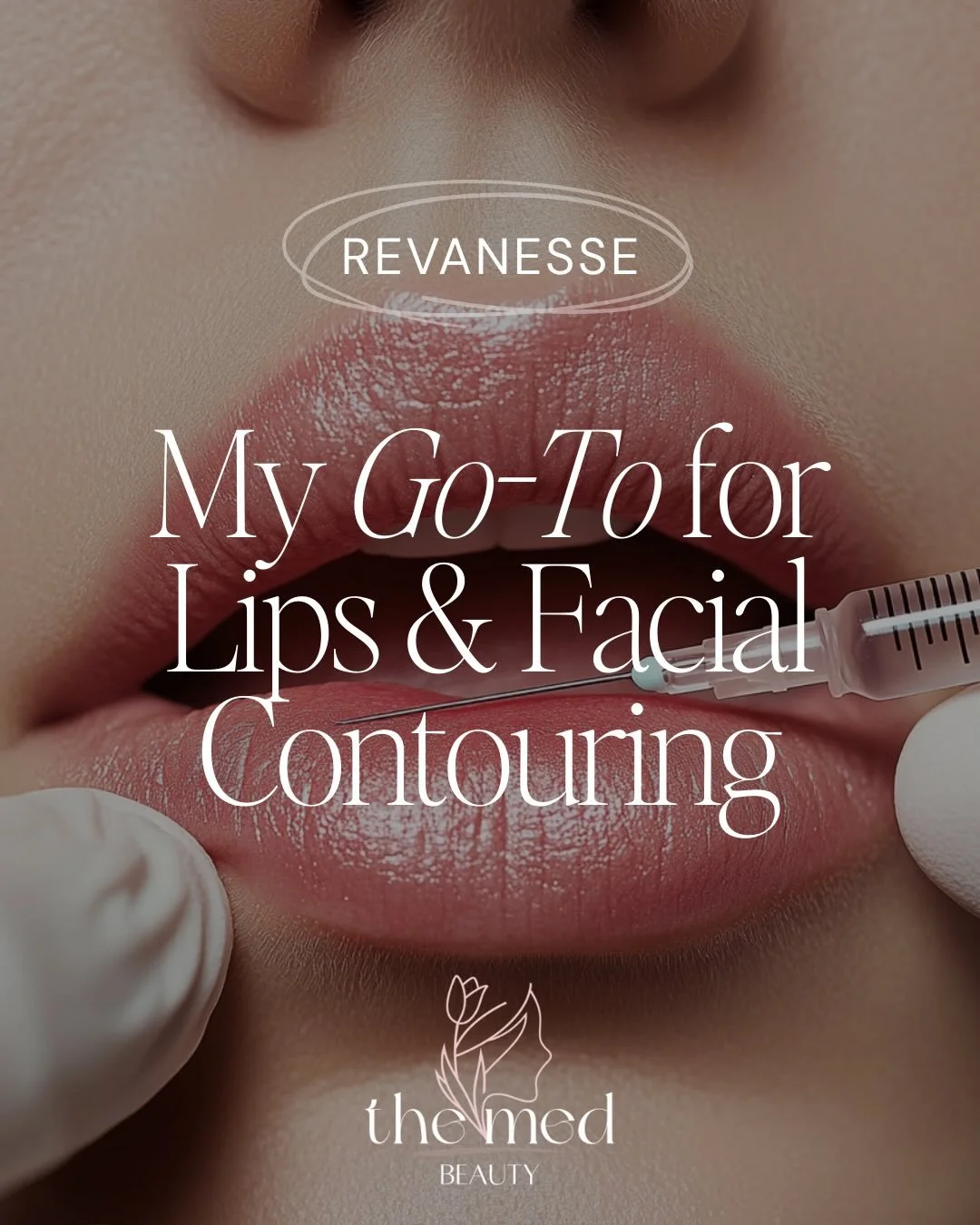 Let&rsquo;s chat Revanesse! 

Not all fillers are created equal and this one? She&rsquo;s the smooth operator. 

💧 Ultra-soft, natural finish
 👄 Pillowy lips without puffiness 
💉 Contour that blends, not bulges 

Less swelling, more glow, and resu