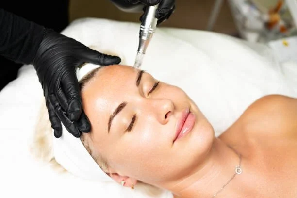 A woman receiving a facial treatment, lying on a bed with her eyes closed, while a practitioner uses a syringe with a needle on her forehead, wearing black gloves.