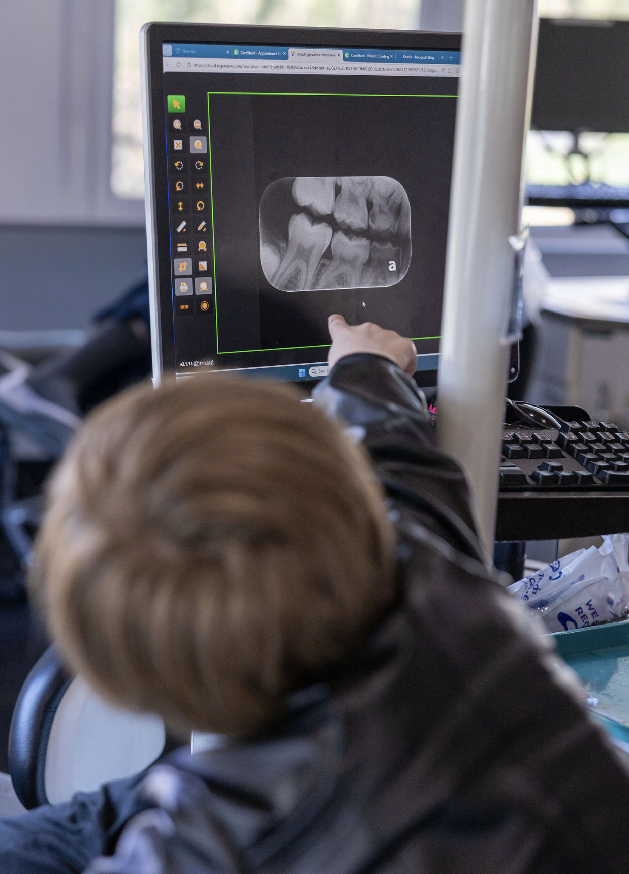 A young boy is pointing to his xrays