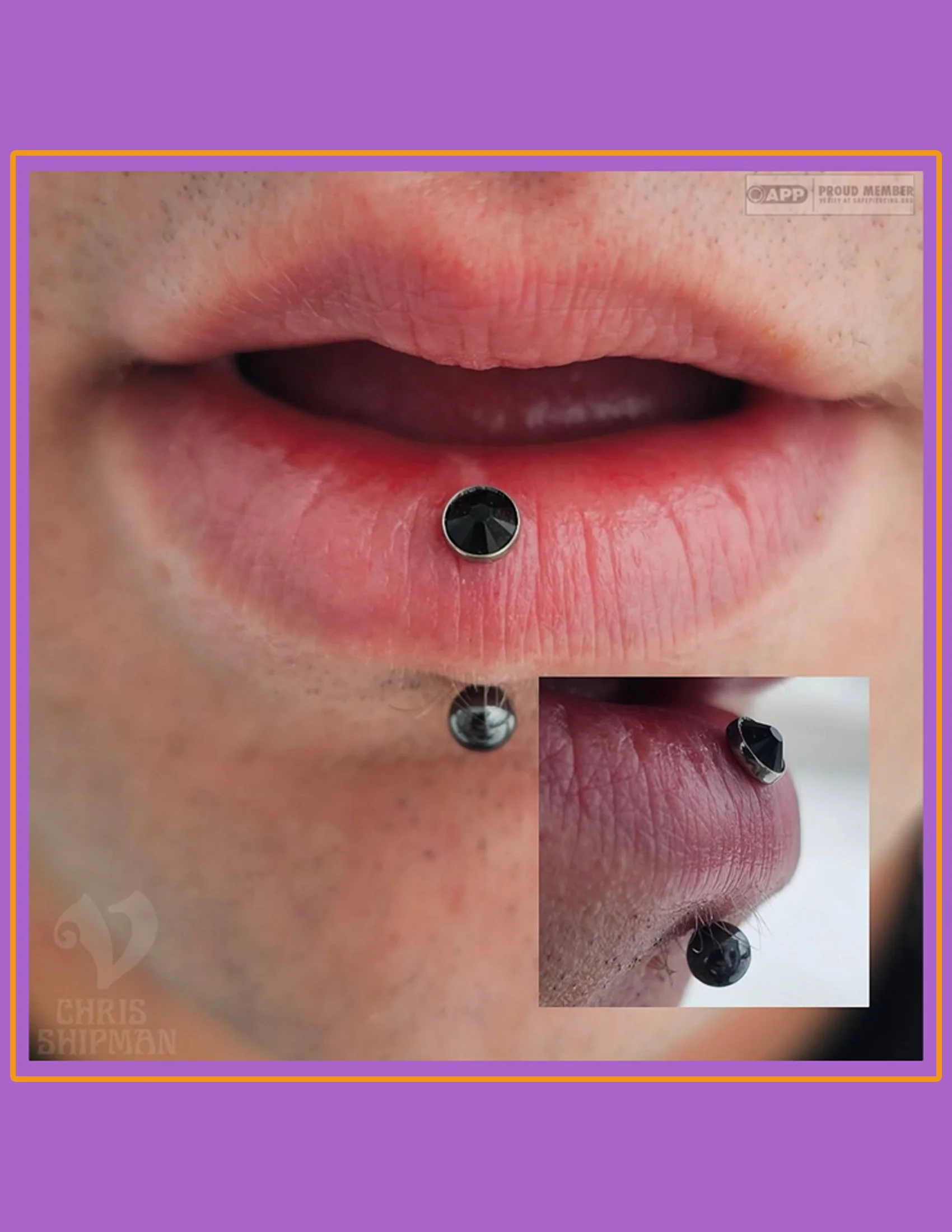 "Freshly downsized vertical labret piercing by Chris Shipman at Visions Tattoo Gallery featuring Anatometal implant-grade titanium jewelry with a black faceted gemstone in Medway, Massachusetts."