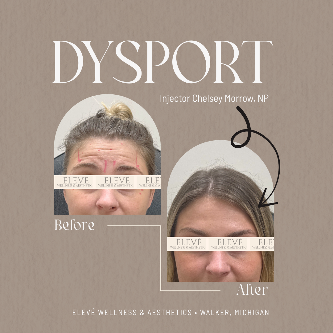 before and after Elevé (1080 x 1080 px) (1).png