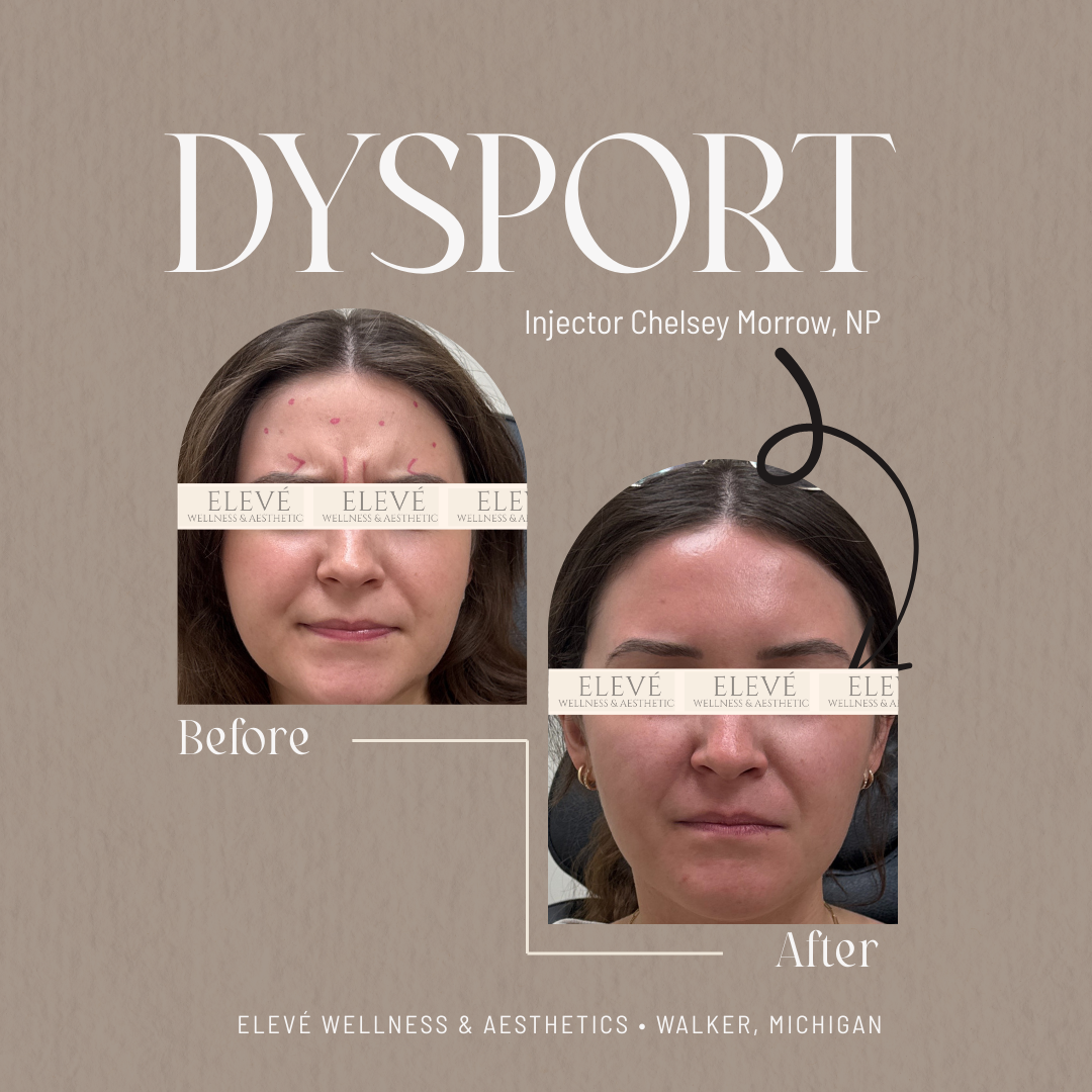 before and after Elevé (1080 x 1080 px) (8).png