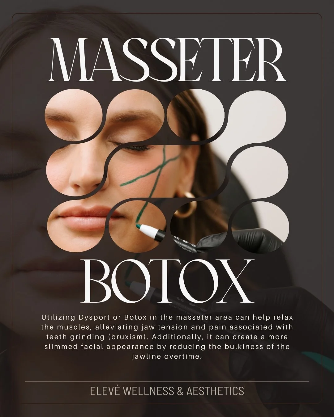 What if one quick treatment could slim your face over time?👇👀

If you struggle with jaw tension, teeth grinding, or feel like your lower face looks heavier than you&rsquo;d like, facial slimming with Tox might be the solution you&rsquo;ve been look