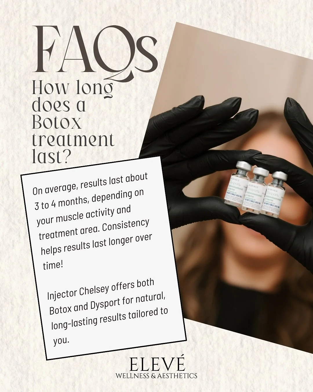 Wondering how long Botox really lasts?👀👇
Most clients enjoy smooth, refreshed results for about 3–4 months. Over time, with consistent treatments, you’ll notice that your results last even longer as muscles become more relaxed.
At Ele