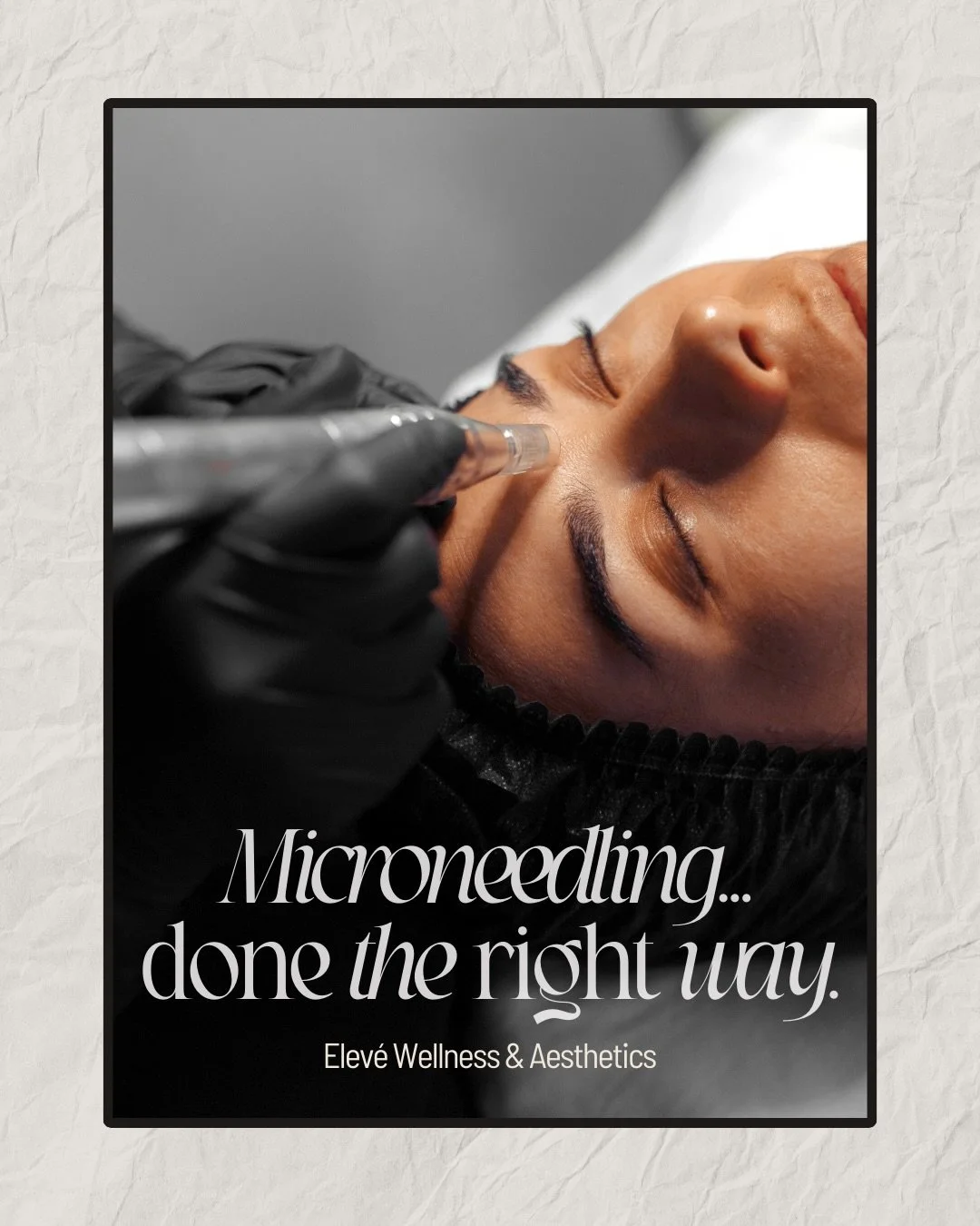 Microneedling that ACTUALLY changes your skin.

Smoother texture, better tone, real collagen &mdash; customized by skin experts who don&rsquo;t guess.

Book your microneedling at Elev&eacute; Wellness &amp; Aesthetics in Walker, MI✨
