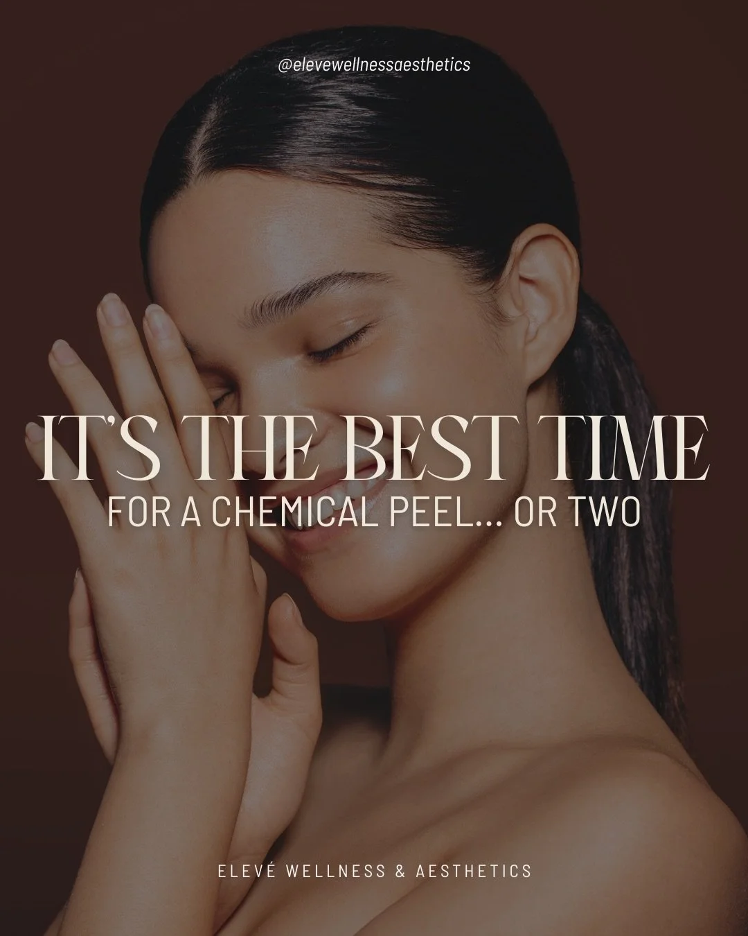 Thinking about a chemical peel?👀

March is actually one of the BEST times to do it. Less sun exposure means safer skin renewal while improving tone, texture, acne, and dullness. 

Ready to refresh your skin? Book your appointment at Elev&eacute;! We