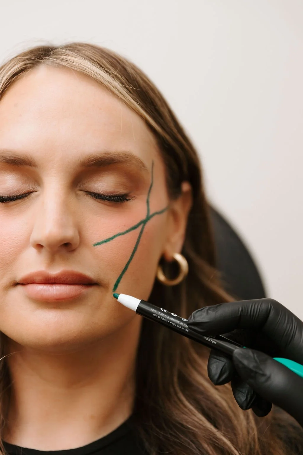 Botox vs Dysport: Which Treatment Is Right for You?