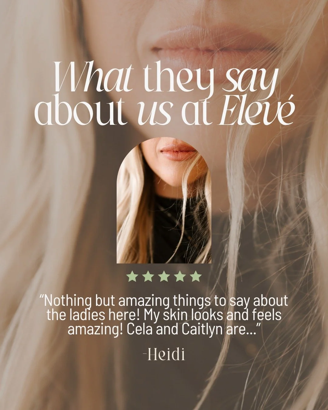 nothing better than results you can see and a team you actually trust 🤍

from the moment you walk into elev&eacute; wellness &amp; aesthetics in walker, michigan, you&rsquo;re taken care of. from cela at the front to customized treatments with caitl