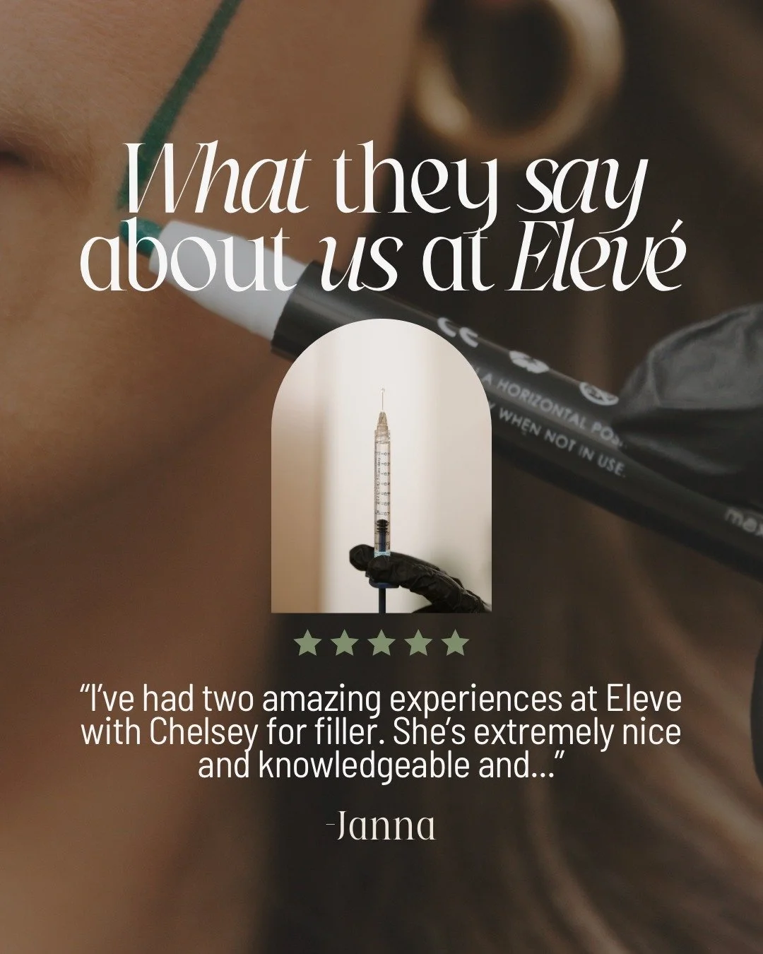 Nervous about filler? You&rsquo;re not alone, &amp; it&rsquo;s EXACTLY why the RIGHT provider matters.🙌

Janna said it best: Chelsey makes the whole experience comfortable from start to finish.

If you&rsquo;ve been thinking about lip or facial fill