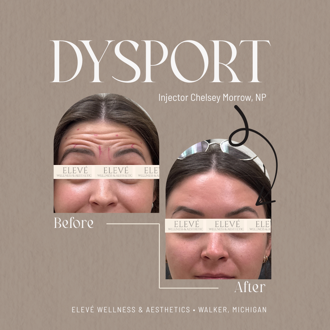 before and after Elevé (1080 x 1080 px) (5).png