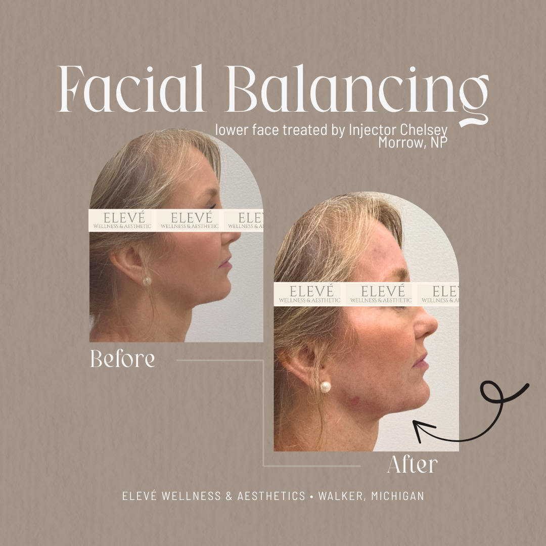 before and after Elevé (1080 x 1080 px) (7).png