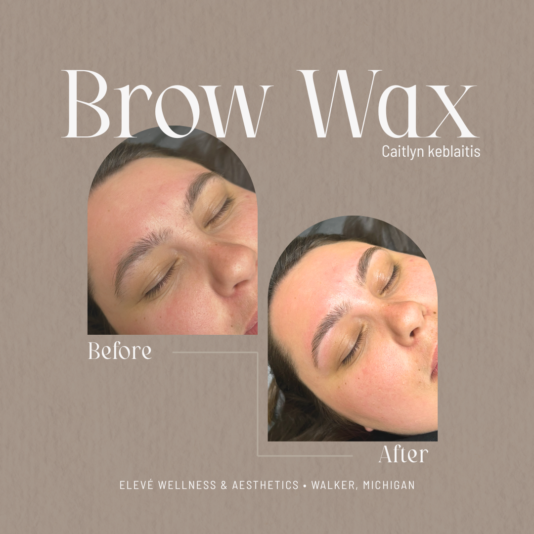 before and after Elevé (1080 x 1080 px) (4).png