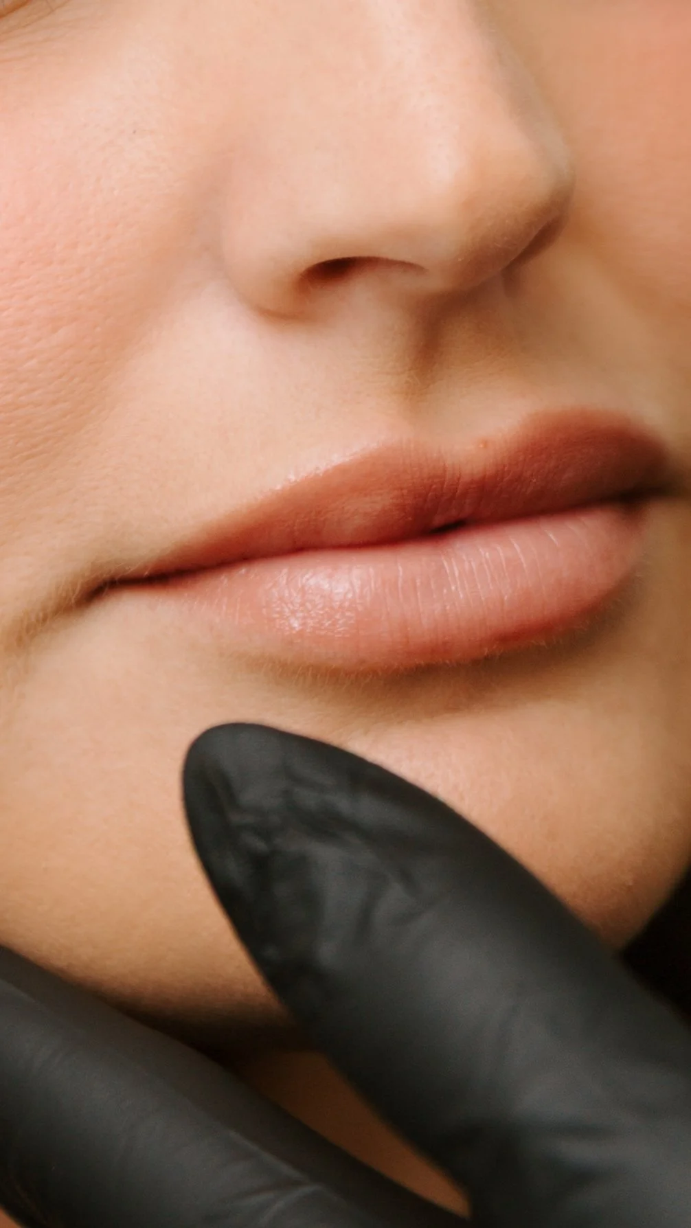 Lip Filler in Grand Rapids