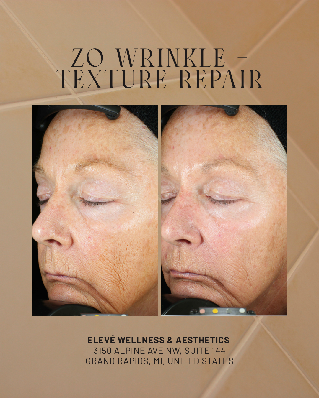 ZO Wrinkle + Texture Repair.png