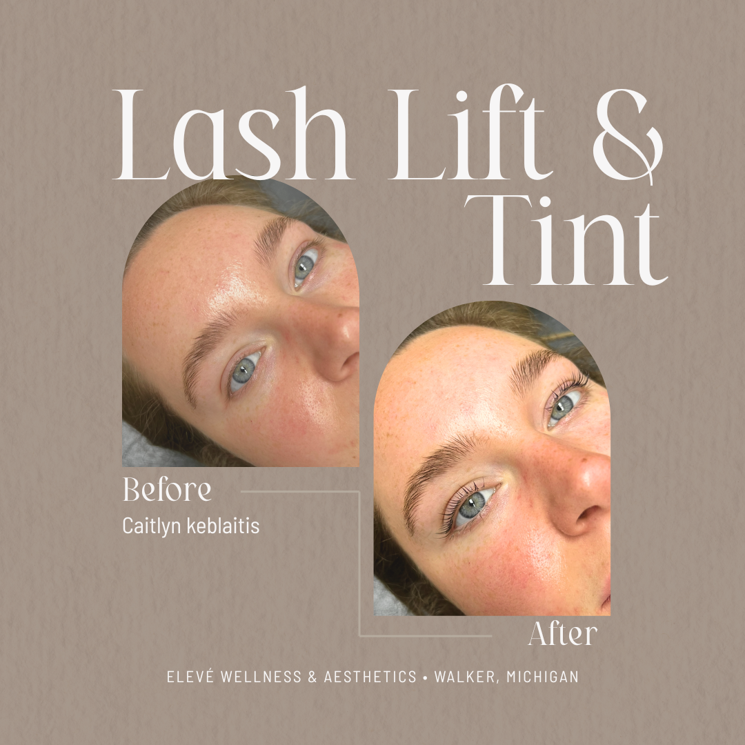 before and after Elevé (1080 x 1080 px) (6).png