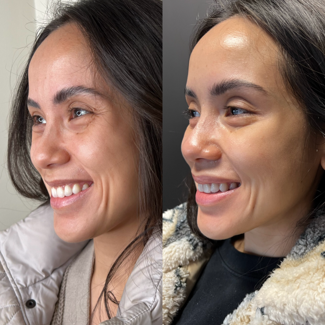 Pure Seoul Aesthetics | Medspa in West Bloomfield Township, MI 48009