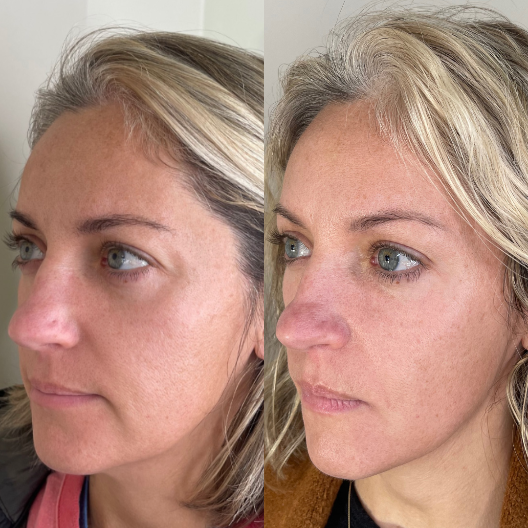 Pure Seoul Aesthetics | Medspa in West Bloomfield Township, MI 48009