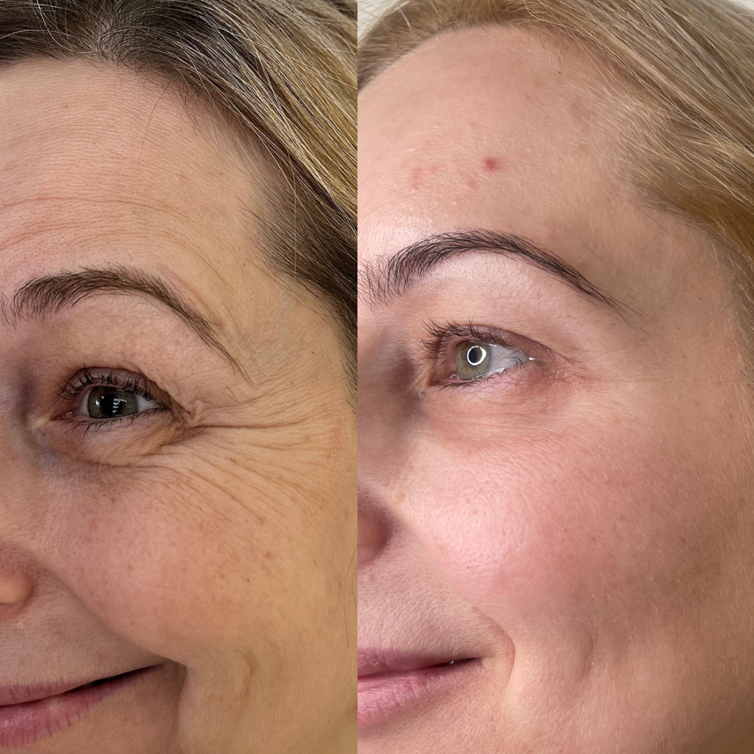 Pure Seoul Aesthetics | Medspa in West Bloomfield Township, MI 48009