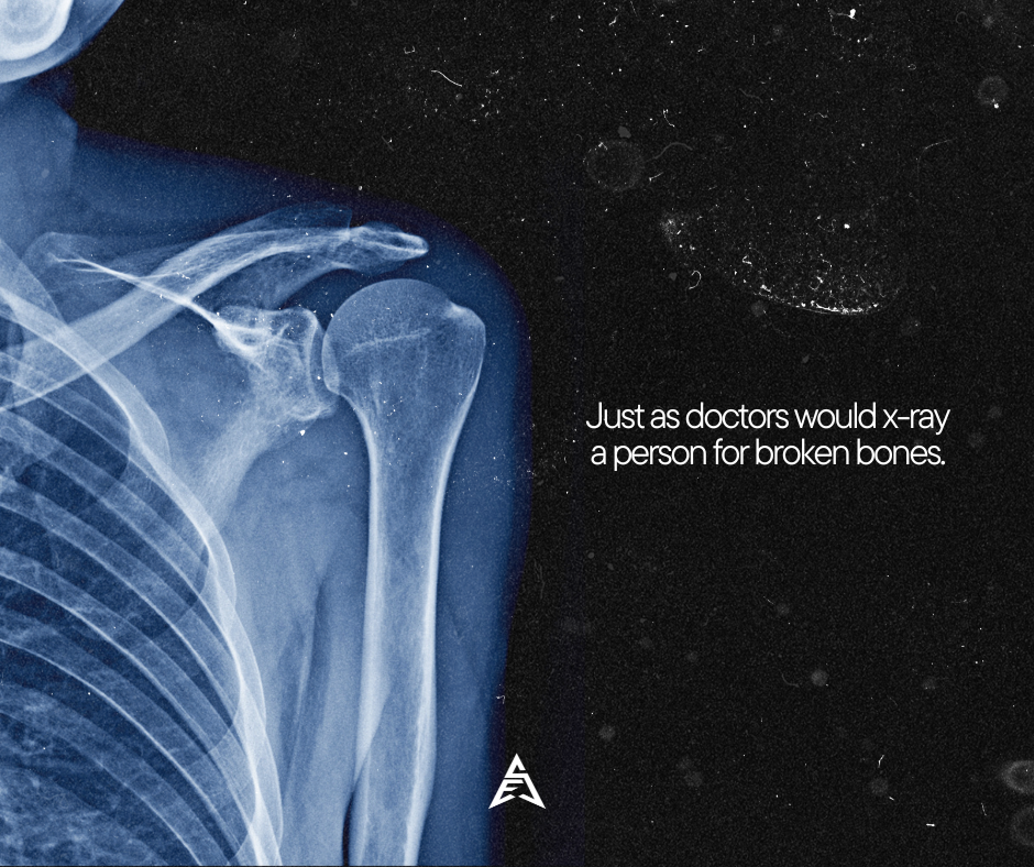 X-ray image of a shoulder with a broken clavicle. Text overlay reads, 'Just as doctors would x-ray a person for broken bones.'