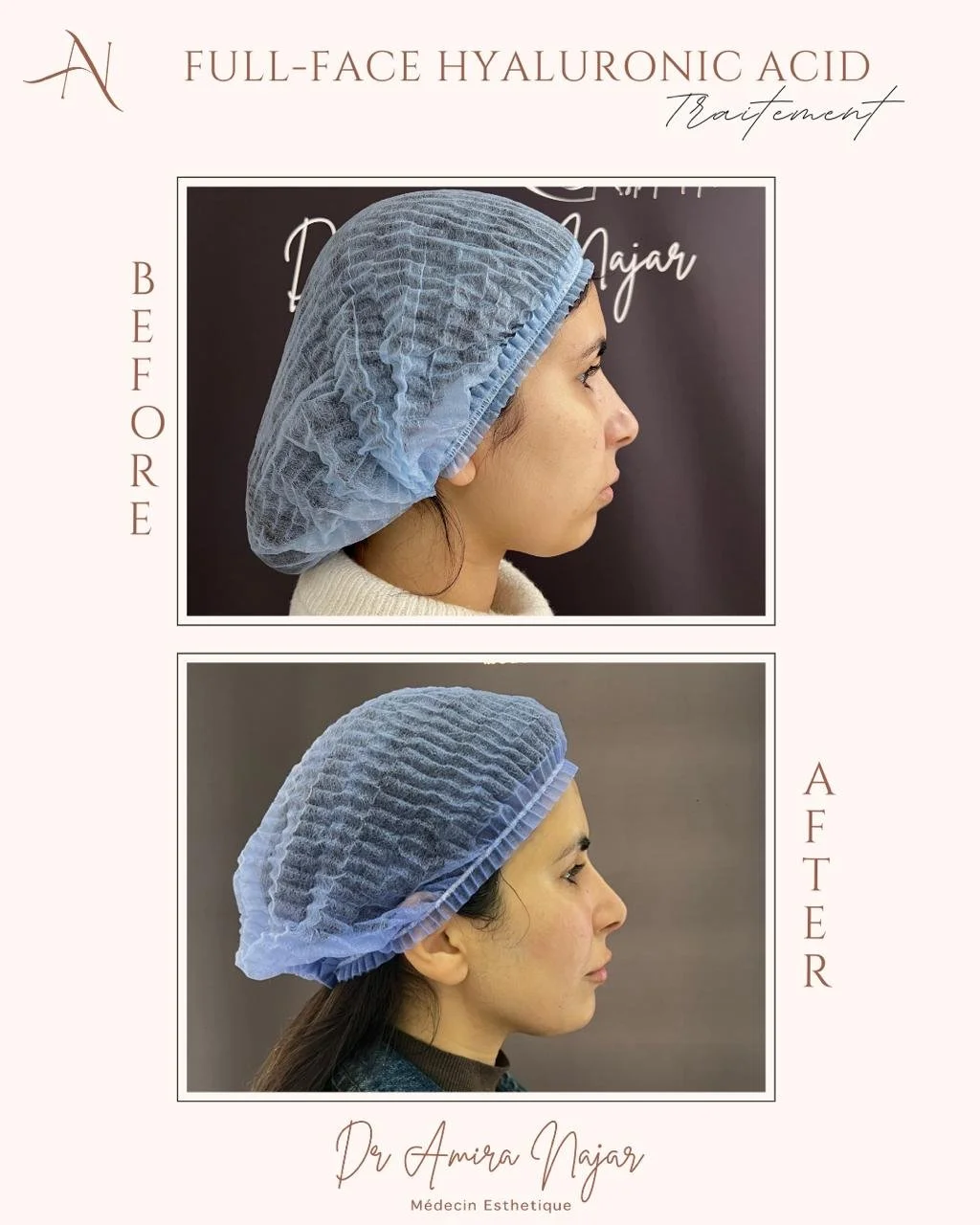 PHOTO-2025-01-05-15-55-55 2.jpg