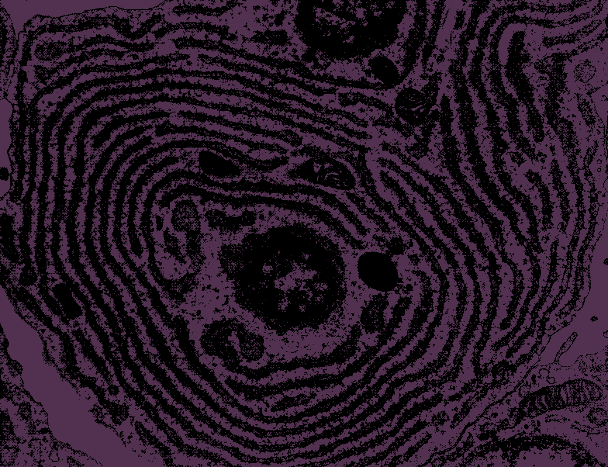 ENDO-ART-3.gif
