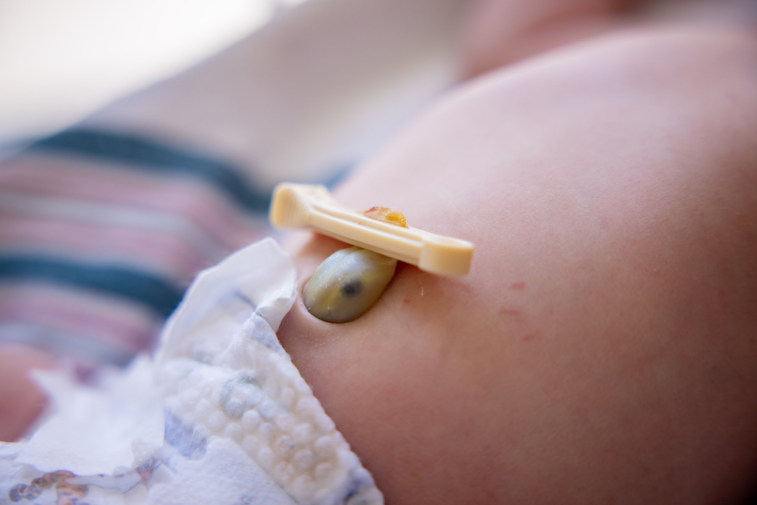 Newborn baby umbilical cord clip at a fresh 48 photography session at Doctor's Hospital of Augusta, GA.