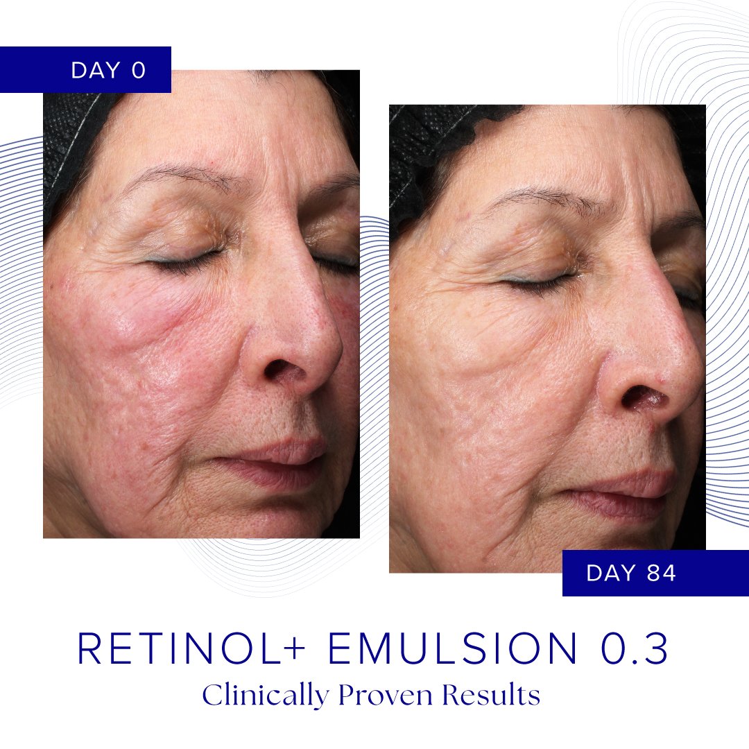 B A_Retinol_results_square_2.jpg