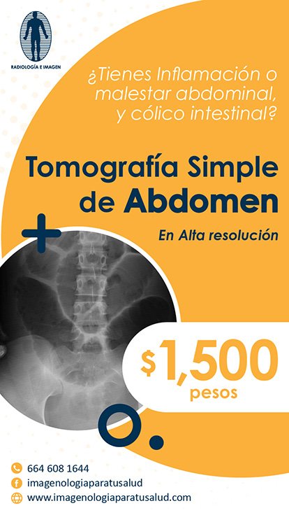 E-Flyer