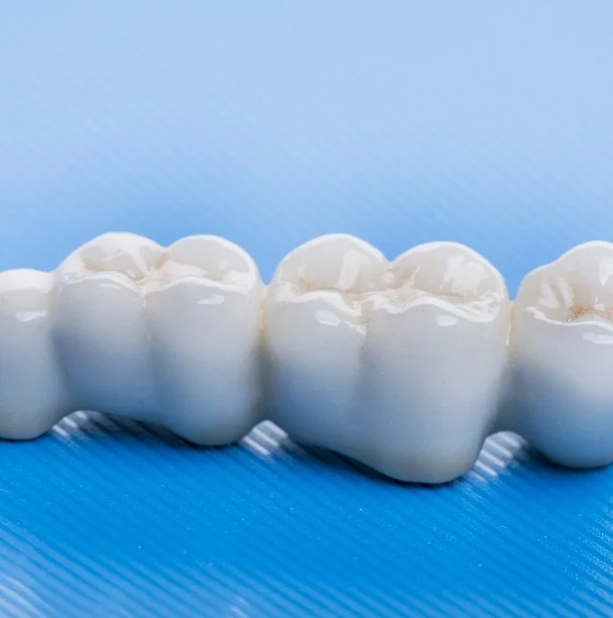 02_img_Couronne1_DentisterieRestau.jpg