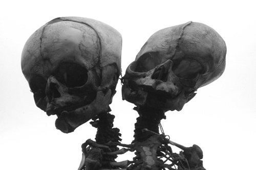 Conjoined skeleton