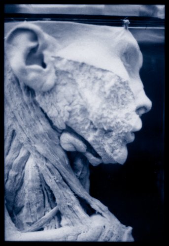 Prosection - Anatomical preparation showing the muscles and glands of the neck