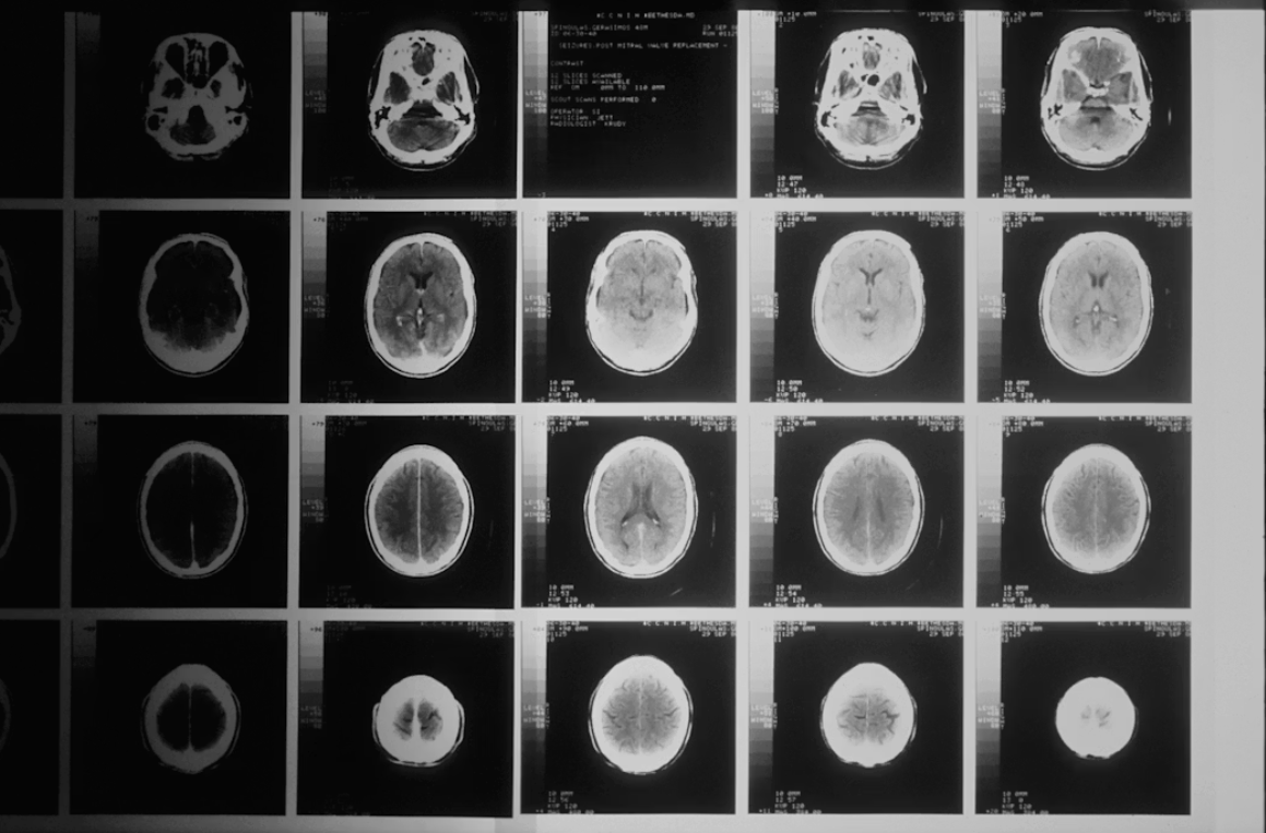 Brain & Nervous System
