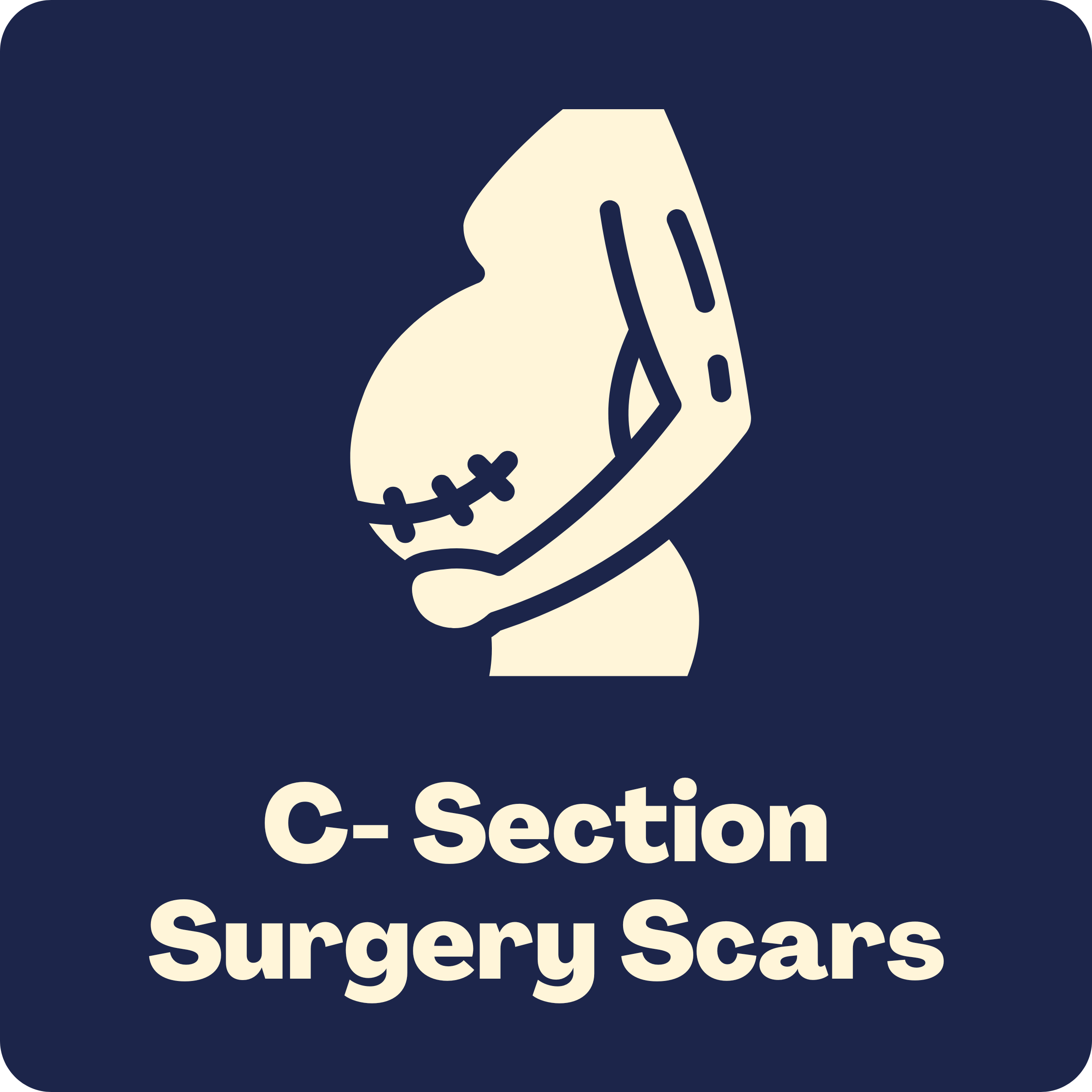 C-Section.png