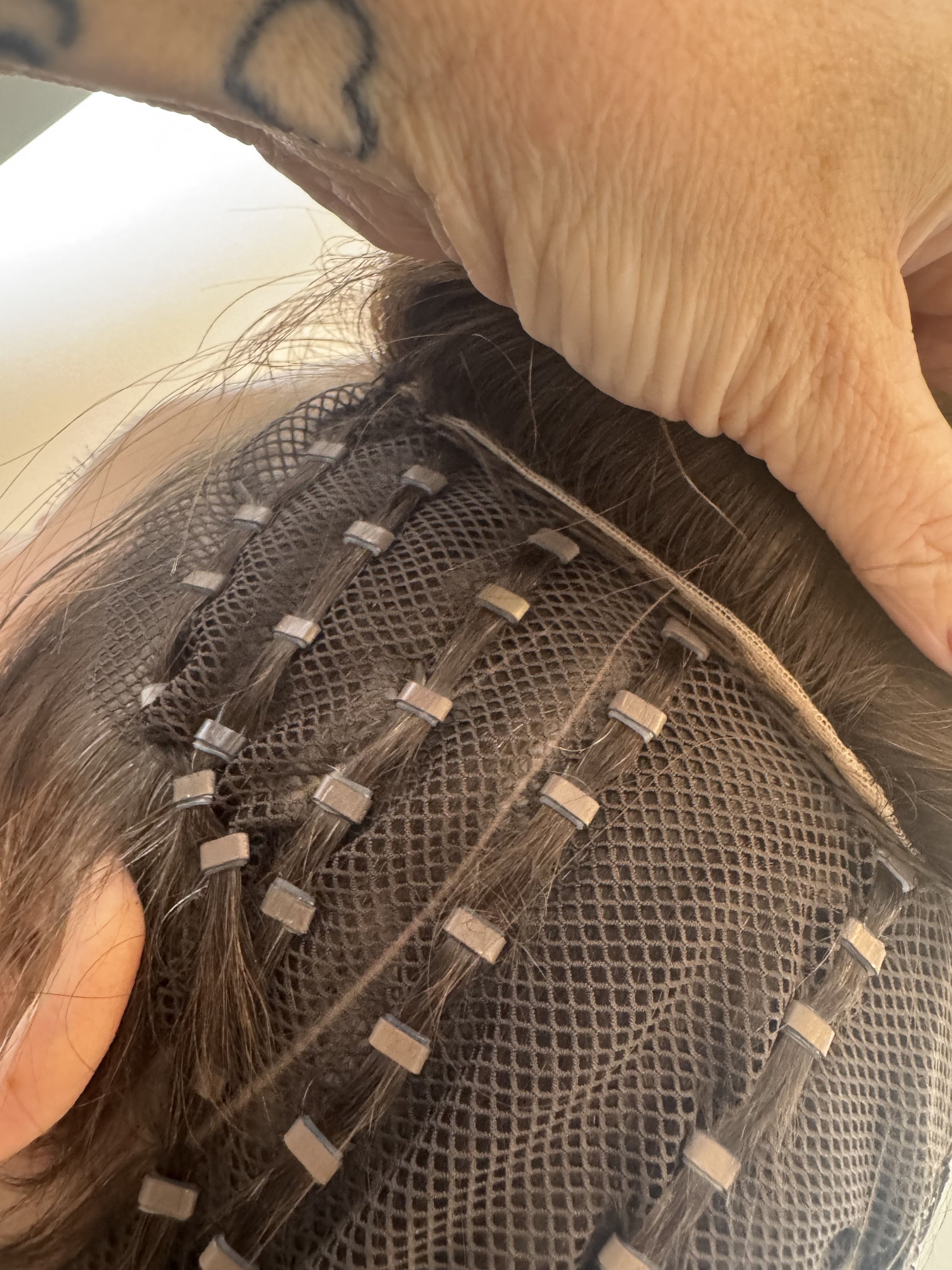 Introduction to Mesh Integration: A revolutionary hair loss solution