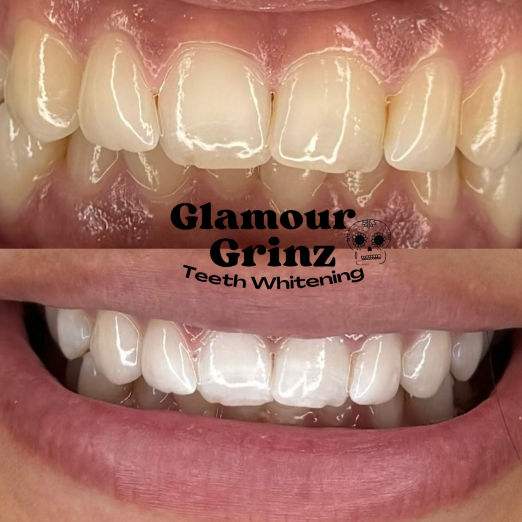 She&rsquo;s definitely glowing after her Teeth Whitening session 😍🦷

Our whitening process is
🩵 Chill and relaxing
🩵 Gentle on teeth
🩵 Cost effective

Tap the link in our bio to Book your appointment 😁

#glamourgrinz #beforeandafter #teethwhite