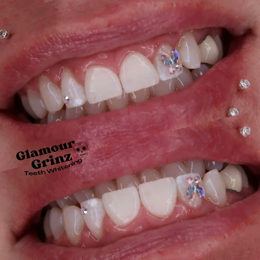 Stuntin with Swarovski&rsquo;s 💖✨

Spots are filling up Don&rsquo;t wait to Book! 🦷

- Glamourgrinz.com

#glamourgrinz #greenbay #wisconsin #greenbayteethwhitening #greenbaytoothgems #glowup #discovergb #swarvoski