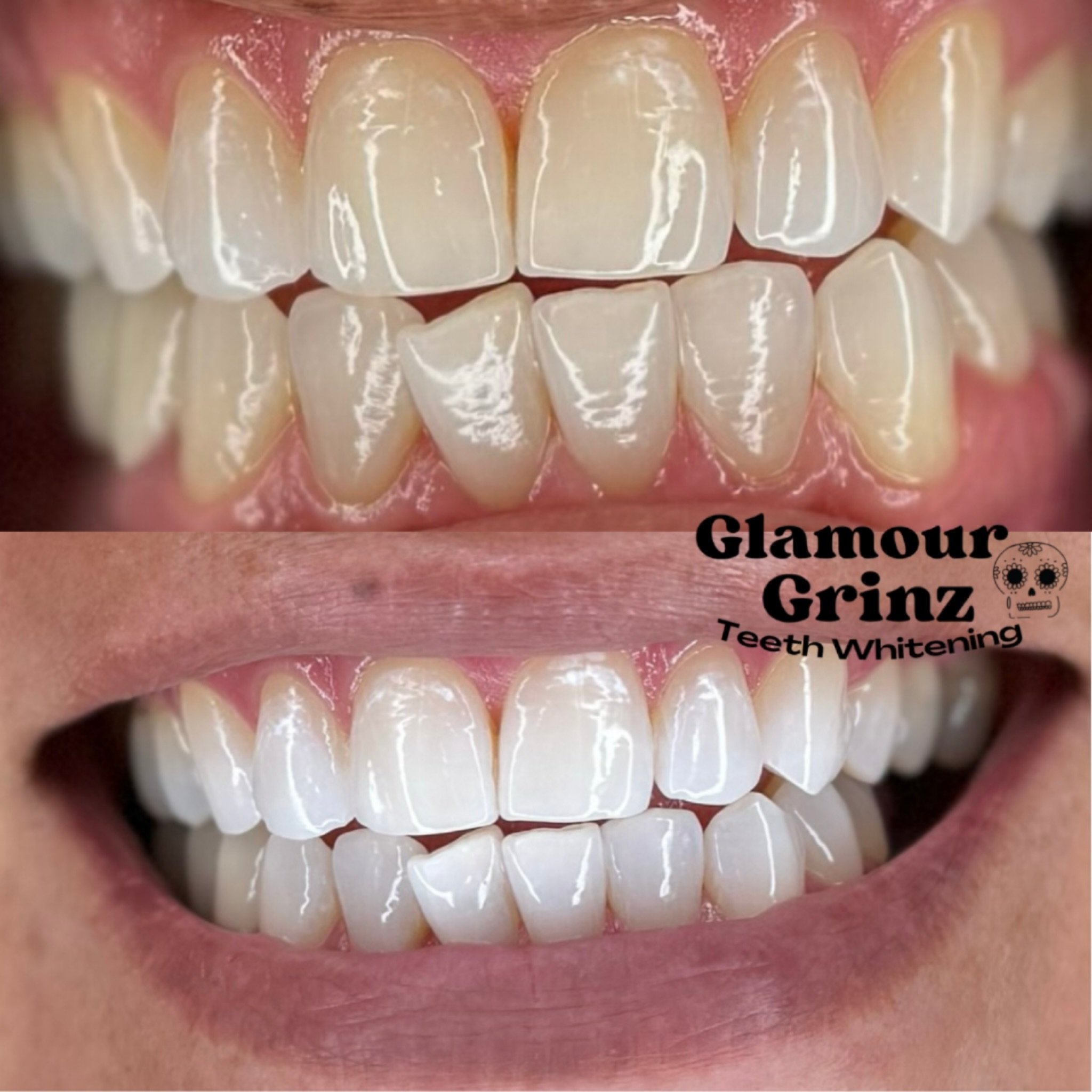 Before &amp; after just 2 Whitening sessions 🤩🦷 
✨ LOOK at that Glow! ✨

Ready for your transformation?⤵️
Click &ldquo;Book Now&quot; on profile | or book thru DM 

.
.

#glamourgrinz #teethwhiteningresults #greenbay #teethwhitening #beforeandafter